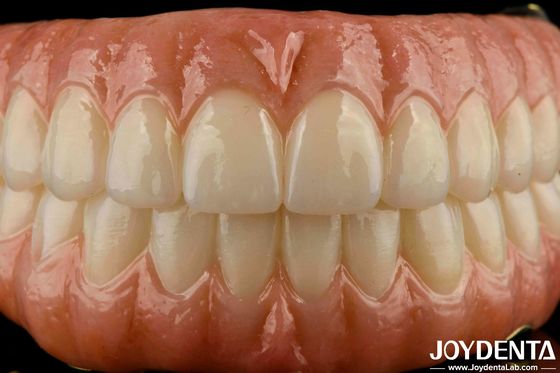 Precise Fit Tandheelkundige Ti-Bar Zirconia Hybride brug vervanging voor ontbrekende tanden