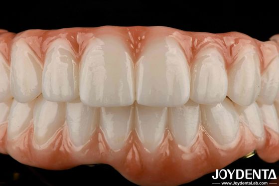Langdurige Titanium Bar Zirconia Hybride Brug Natuurlijke uitstraling Esthetiek voor herstel