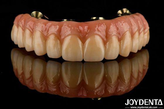 Tandheelkundige Ti-Bar Hybride Zirconia Brug Uitstekende sterkte Herstelt kauwfunctie