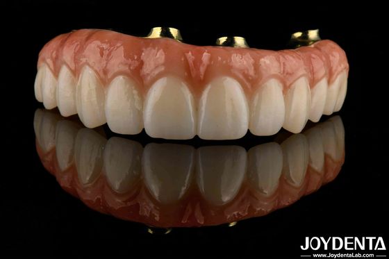 Comfortabel draagbaar Titanium Bar Zirconia Hybride Bridge Hoog Biocompatibiliteit Langdurig