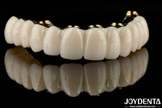 Glanzige Hybride Zirconia Implantatiebrug Herstel kauwfunctie Op maat gemaakt