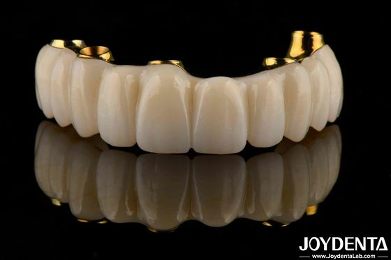 Precision Dental Titanium Bar Hybride Zirconia Bridge Aanpassing Hoge biocompatibiliteit