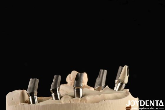 Op maat gemaakte gepolijste titanium-abutment cementretentie V-vormige draadtype