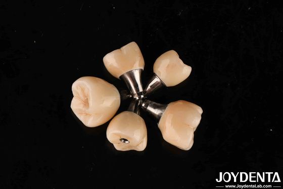 Schroefretentie Titanium abutments Interne hexverbinding voor tandheelkundige implantaten