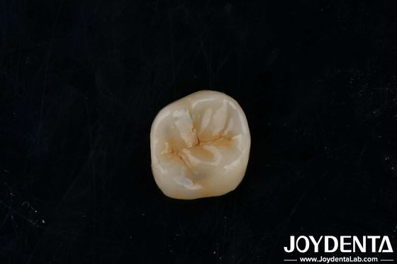 Aanpasbare kleefmiddel Zirconia Inlays Onlays Hoogtranslucentie Voor Herstel