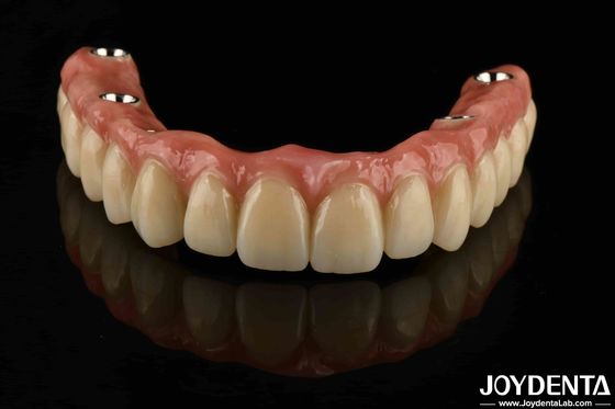Gepaste Titanium Malong tandheelkundige hybride brug corrosiebestendigheid verstelbaar