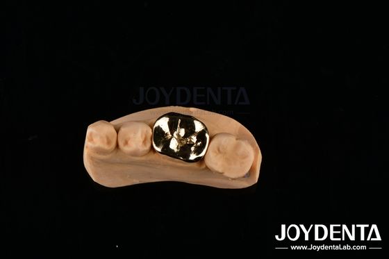 Metalen FMC orale klinische reparatie tandheelkundige implantaten met slijtvastheid