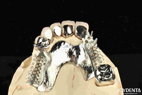 Metalen tandheelkundig frame met legering Afneembare draagbare voor tandartsen