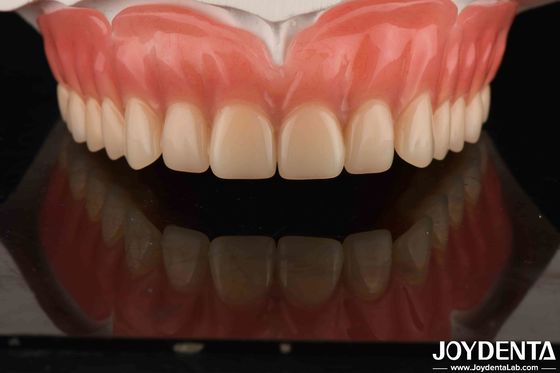 Acryl Tanden Afwerking Lichte hars Materiaal Tandheelkundige restauraties Tandverzorging