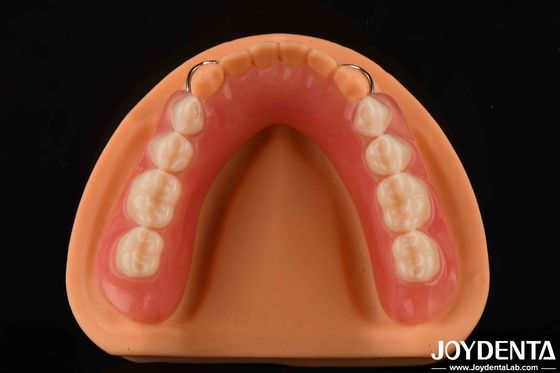 Gepersonaliseerde aanpassing Acrylprothese Afwerking Lichtgewicht Hoge elasticiteit