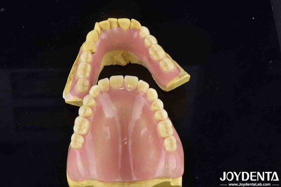 Natuurlijke tand morfologie Flexible tandheelkundige afwerking voor comfortabele veilige pasvorm