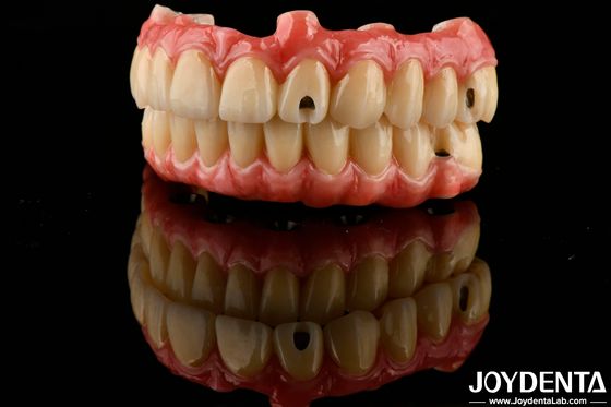 Uitstekende elasticiteit tandheelkundige acrylprothese afwerking met lichtgewicht eigenschappen
