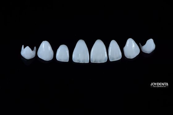 0.3-0.5 mm dik natuurlijk porselein Emax fineer hoge sterkte langdurig voor esthetiek