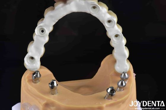 Hoge sterkte Ti-Base Hybride Zirconia Bridge Fracture Resistance tandheelkundige oplossing