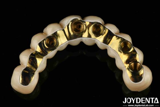 Op maat gemaakte Ti-Bar Zirconia Hybrid Bridge Precision Fit Tandheelkundige Prothese