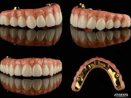 Ti Bar Zirconia Hybride Implantatiebruggen Hoge doorschijnendheid Voor tandheelkundige prothesen