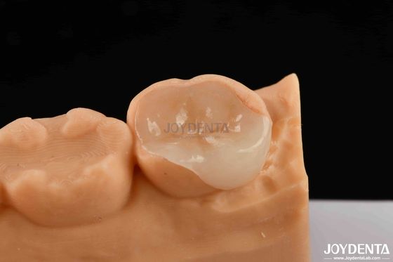 Polymerisatie van porselein, composiet, esthetische en duurzame restauraties