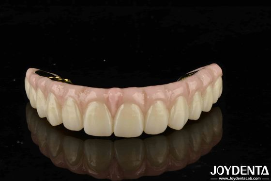 Hoge duurzaamheid Zirconia Ultieme oplossing voor natuurlijke tanden en tandvlees compatibiliteit