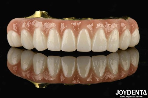 Titanium en Zirconia Comfort Comfortabel om te dragen Ti-Bar Zirconia Hybride brug voor vervanging van ontbrekende tanden
