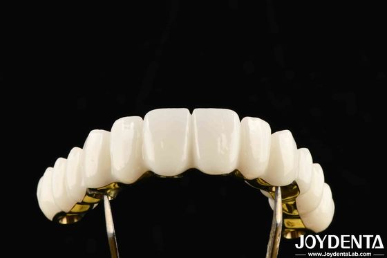Op maat gemaakt Zirconia Uitstekende sterkte voor gepersonaliseerde tandheelkundige oplossingen