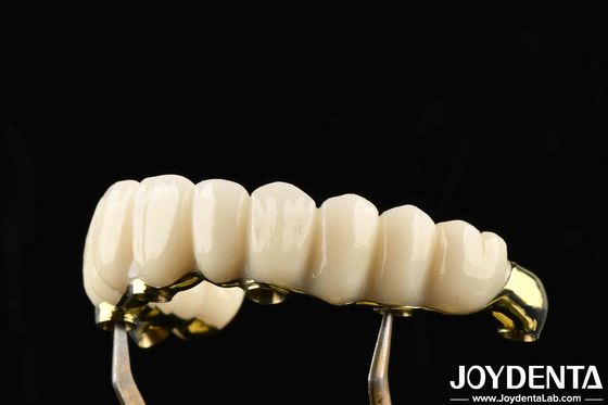 Comfortabel om te dragen Ti-Bar Zirconia Hybrid Bridge Herstelt kauwfunctie Compatibel met natuurlijke tanden en tandvlees