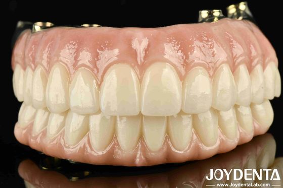 Hoge duurzaamheid Ti-Bar Zirconia Hybride brug op maat gemaakt voor persoonlijke tevredenheid gegarandeerd