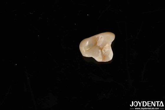 Niet-toxisch E-max materiaal Ultieme oplossing Emax Inlay Onlay voor biocompatibiliteitsnormen