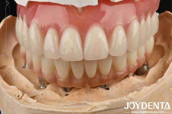 Goed elastisch tandheelkundig acrylprothese afwerking met tandarrangement technologie
