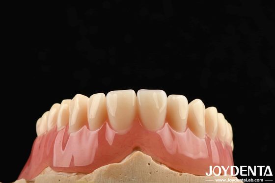 Goed elastisch acrylprothese afwerking voor lichtgewicht gepersonaliseerde aanpassing en gepersonaliseerd ontwerp