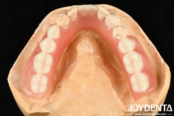 Verscheiden en lichtgewicht harsmateriaal Acryl prothese afwerking