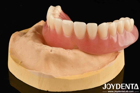 Goed elastiek Acrylprothese Finish Diverse tandarrangement Technologie voor natuurlijke resultaten
