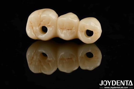 Hoge esthetiek Hoge buigsterkte 1000 MPa Volledig Zirconia Voor Normen