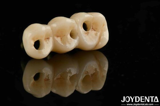 Uitstekende biocompatibiliteit en hoge sterkte Kleur realistisch volledig Zirconia Voor B2B-aankoopoplossingen