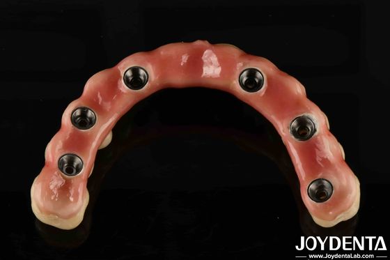 Verstelbare Titanium Malong Hybride Brug Perfecte combinatie van traditionele en moderne technieken