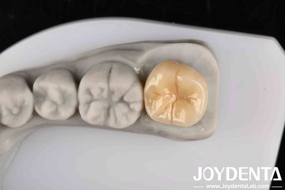 Hoge weerstand tegen thermische schokken en corrosie Volledig Zirconia met uitstekende chemische stabiliteit