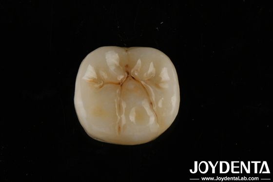 Hoge doorschijnendheid volzirkonium met lagen Biocompatibiliteit en buigsterkte van 800 MPa