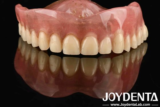 Goede biocompatibiliteit Gepersonaliseerde aanpassing Acrylprothese afwerking voor lichte en duurzame oplossingen