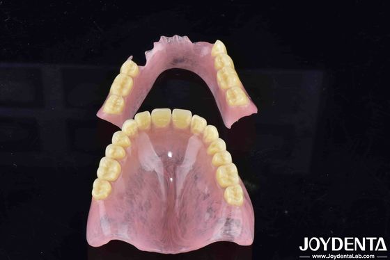 Geavanceerde tandarrangementtechnologie Acrylprothese met een goede elasticiteit en verschillende kenmerken