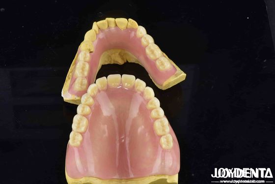 Ontketen het potentieel van uw tandartspraktijk Acrylprothese met diverse en lichte eigenschappen