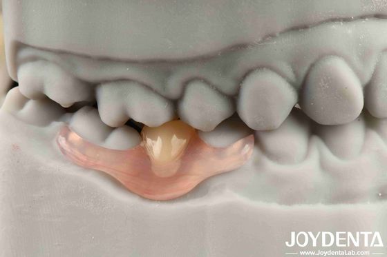 Flexible tandheelkundige afwerking Gepersonaliseerde aanpassing en geavanceerde tandarrangement technologie voor aangepaste behoeften