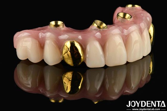50 ml Dentwre uit de Verenigde Staten Uw ultieme oplossing Ti-Bar Acryl Tanden Afwerking Voor tandheelkundige behandeling