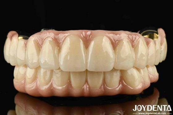 Uitstekende sterkte Ti-Bar Zirconia Hybride brug voor natuurlijke tanden en tandvlees compatibiliteit