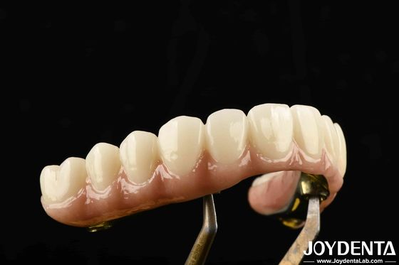 Duurzame Ti-Bar Zirconia Hybride brug gemaakt van titanium en Zirconia materialen voor zware ons
