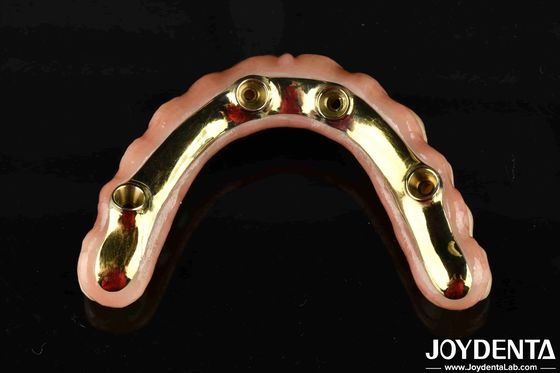 Comfortabel om te dragen Ti-Bar herstelt kauwfunctie Essentiële Ti-Bar Zirconia Hybride Bridge Voor B2B-transacties