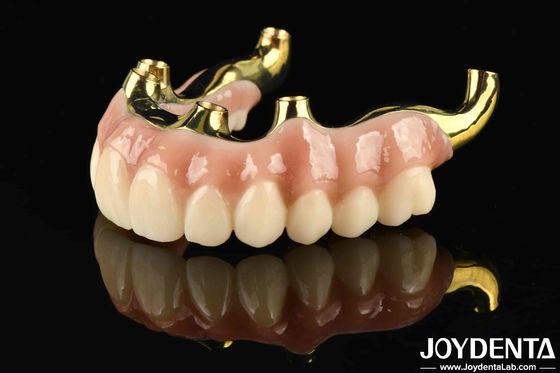 Herstel van kauwfunctie Ti-Bar Zirconia Hybride brug met hoge biocompatibiliteit en precieze pasvorm