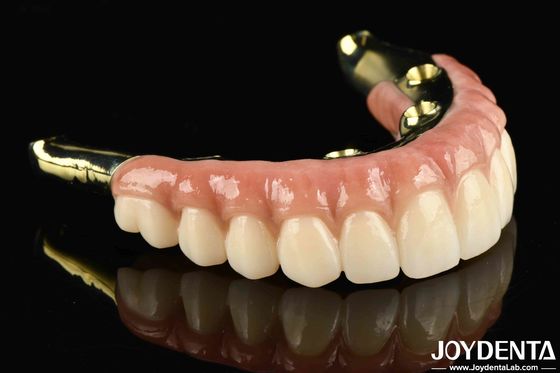 Zeg afscheid van ontbrekende tanden met Zirconia
