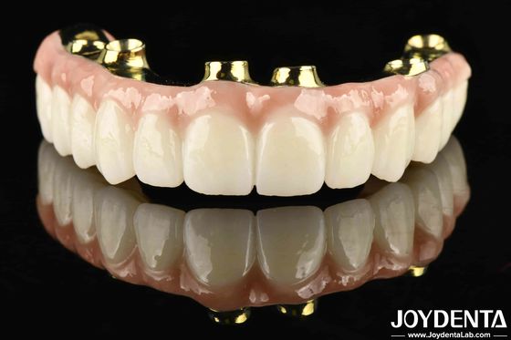 Hoogduurzame en langdurige Ti-Bar Zirconia Hybride brug met corrosie en slijtvastheid