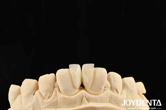 Hoge duurzaamheid Micro veneer 0.2 mm dikte en betrouwbare prestaties