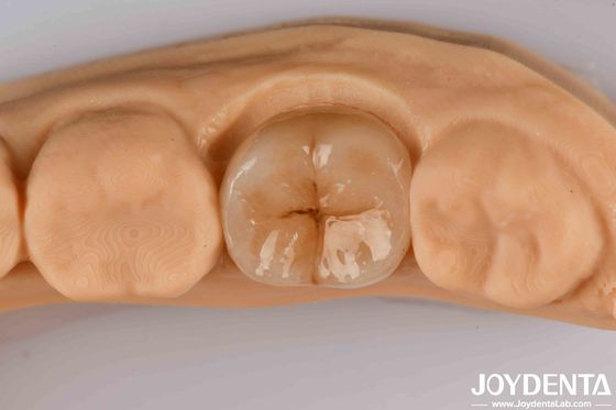 Hoge precisie toepassingen Volle Zirconia met hoge weerstand tegen thermische schokken