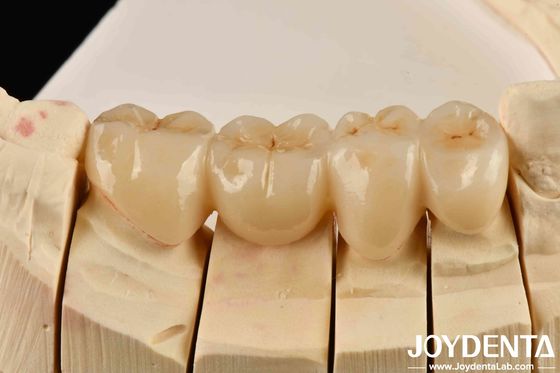 Ontsluit de esthetiek van hoge esthetiek vol Zirconia met wit en weerstand tegen thermische schokken hoog